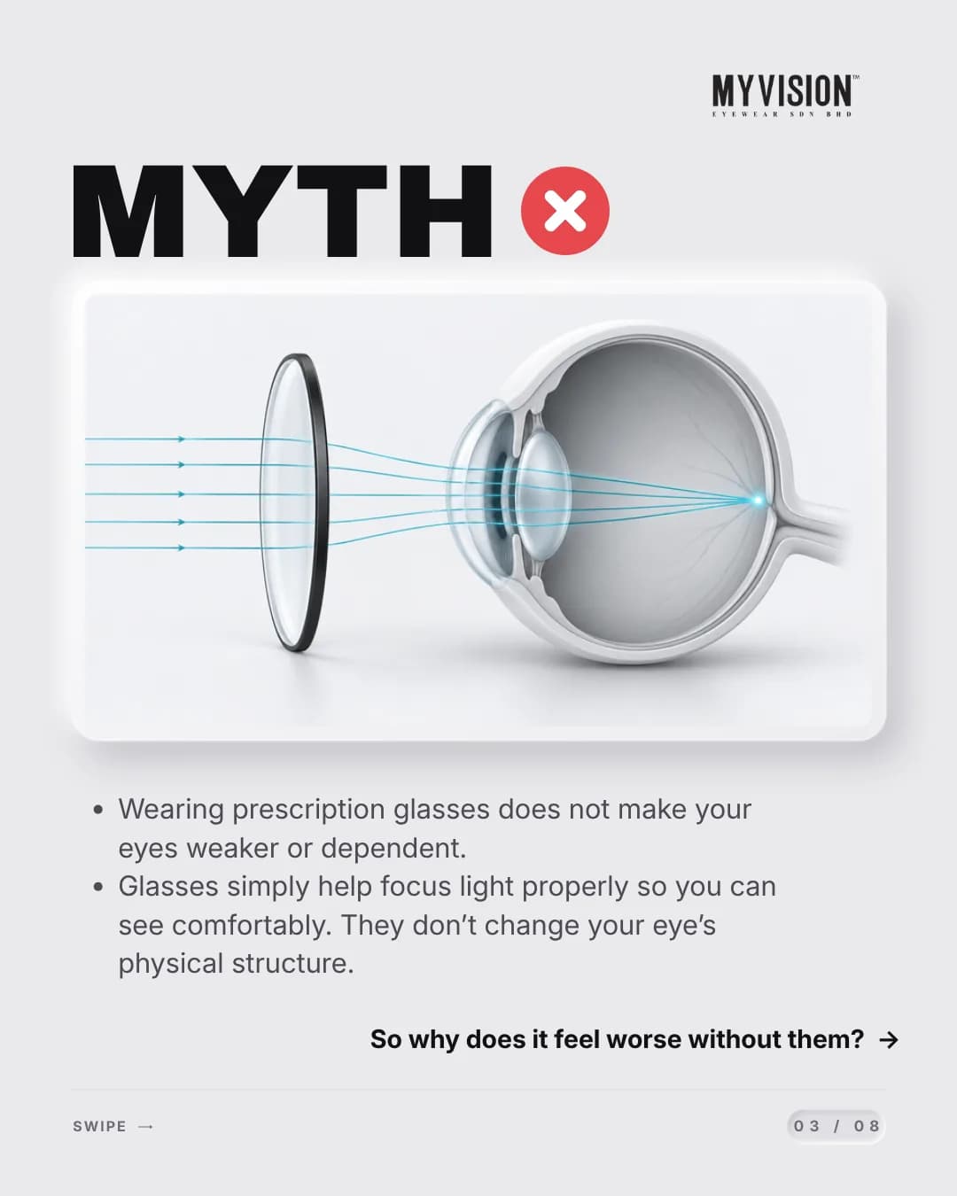 A diagram of light rays passing through a spectacle lens and focusing inside the eye.